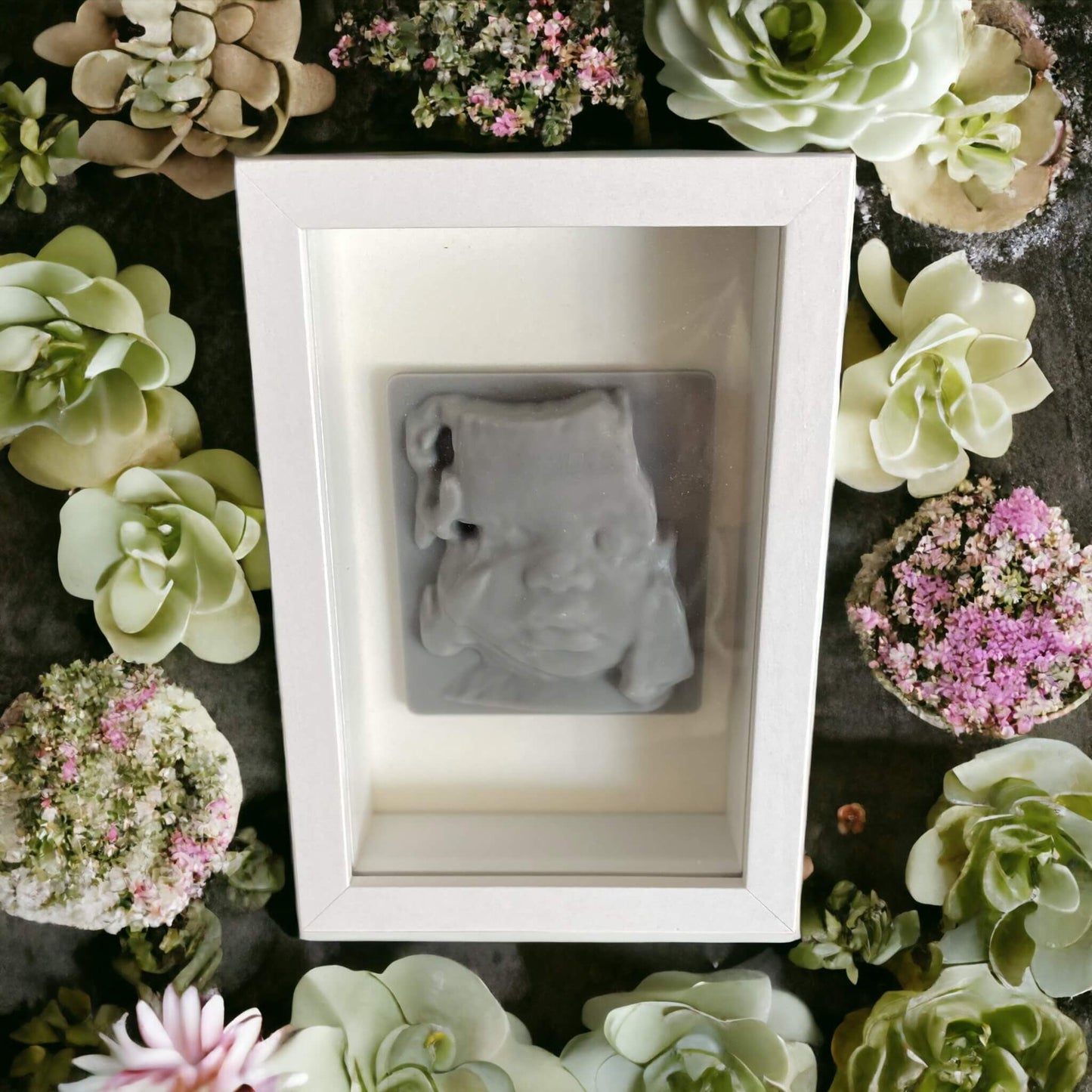 Shadow Box 3D Ultrasound Display